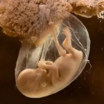 مایع آمنیوتیک